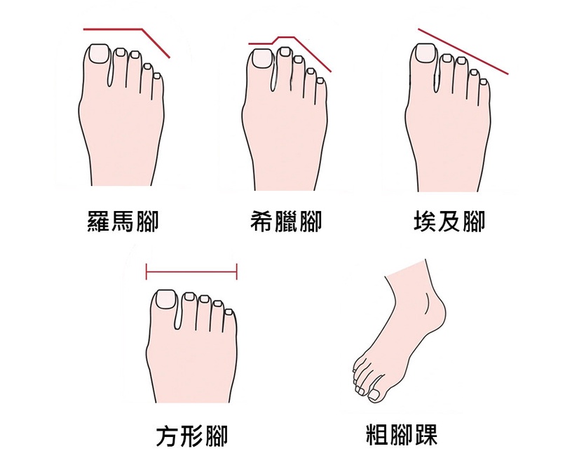 不同腳型挑選涼鞋技巧!寬大腳板、胖腳踝救星是這款,挑對命定鞋款一整天舒適無負擔