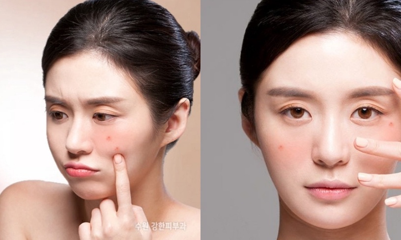 敏感肌必看!敏感肌保養「修護型乳液」推薦,搭配護理Tips提升肌膚防禦力
