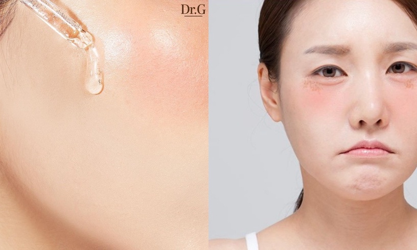 敏感肌必看!敏感肌保養「修護型乳液」推薦,搭配護理Tips提升肌膚防禦力