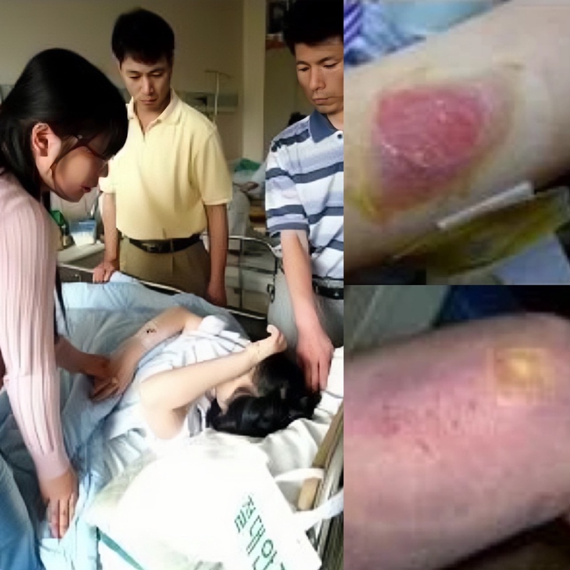 《黑暗榮耀》裡「捲髮棒燙人」為真實事件!當年加害者手法更殘暴,結痂後再撕下繼續燙